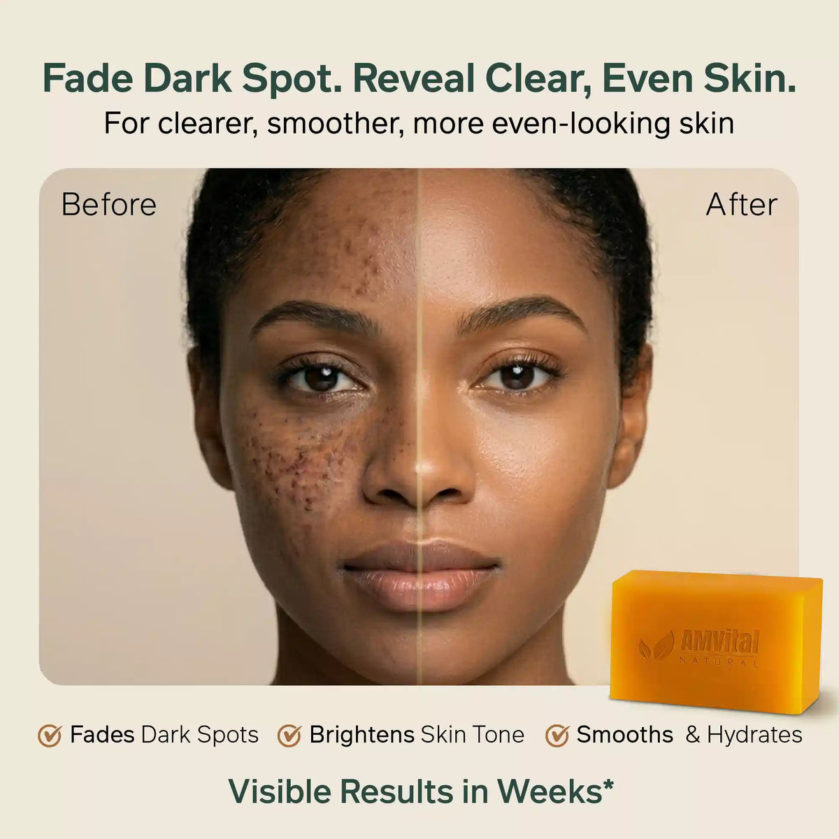 AMVital Turmeric Kojic Acid Soap Bar for Dark Spots &amp; Uneven Tone