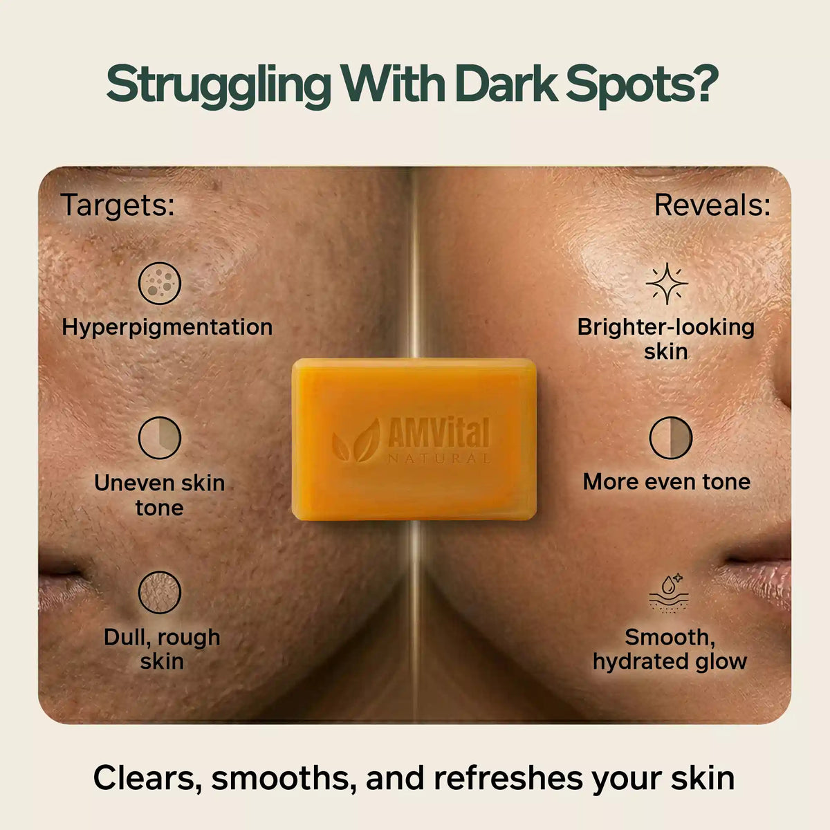 AMVital Turmeric Kojic Acid Soap Bar for Dark Spots &amp; Uneven Tone